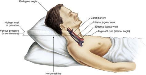 Cardiovascular Clinical Assessment | Nurse Key