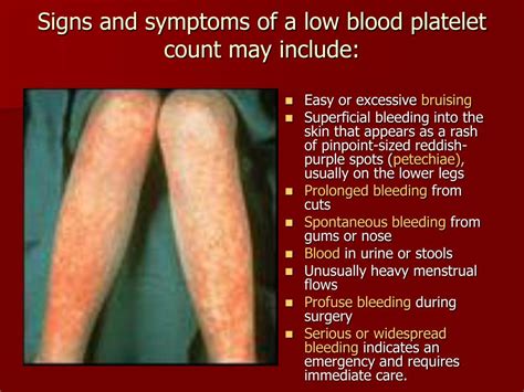 Platelet Count