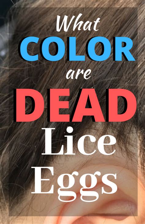 Dead vs Live Nits: Color of Lice Eggs - My Lice Advice