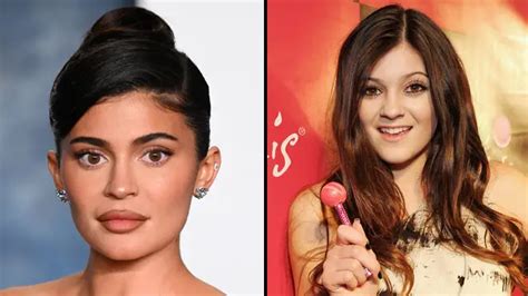 Kylie Jenner opens up about the plastic surgery she's had done on her ...