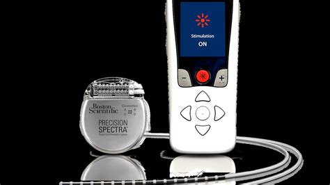 Boston Scientific Spinal Cord Stimulator Side Effects Science - Science Choices