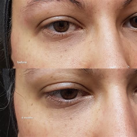 The Inkey List Retinol Eye Cream Review | Raiyne On Beauty