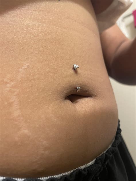 Is my floating navel piercing properly placed? Got it pierced 3 days ago, no problems with ...