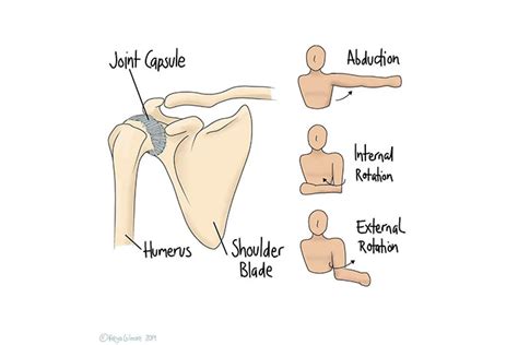 Symptoms, causes and management of frozen shoulder - The Carlton Clinic