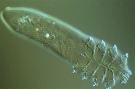 Learn If You Are Showing Signs of Eye Mites or Demodex (With images) | Demodex, Eye mites ...