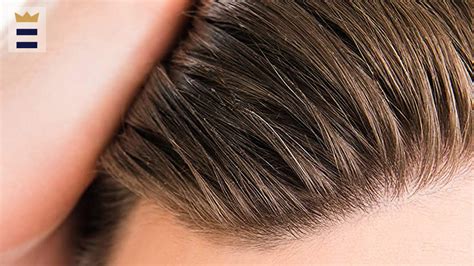 Are The White Flakes on Your Scalp Dandruff? | Think Twice