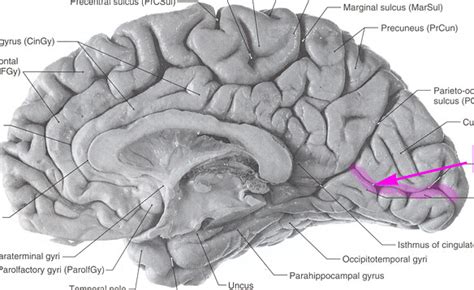 Calcarine Sulcus | From my teacher's personal application fo… | Flickr