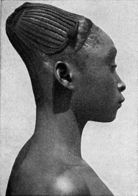 Vanuatu People Cranial Deformation