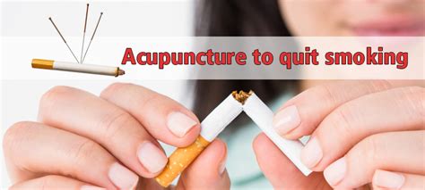 Acupuncture to quit smoking - DiscoverHealth