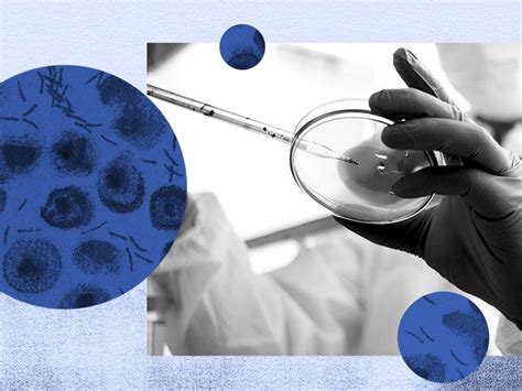 Gram-positive bacteria: Characteristics, treatment, and examples ...