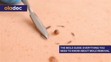 Understanding the Nutritional Needs of Moles: A Guide to Keep Them Away