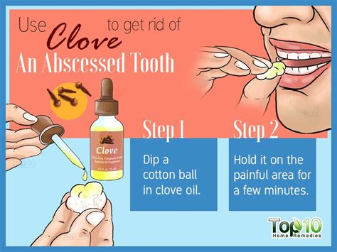 Tooth Abscess Home Treatment