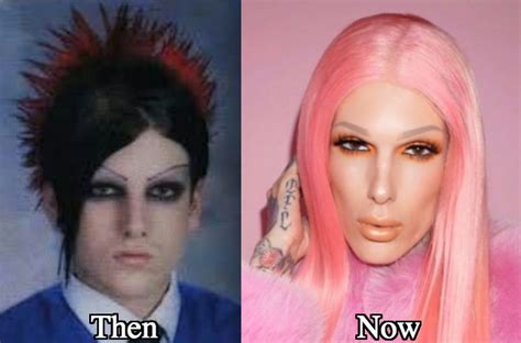 Jeffree Star Plastic Surgery Before and After Photos - Latest Plastic Surgery Gossip And News ...