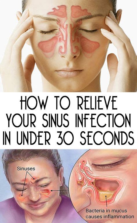 Quick Way To Relieve Sinus Pressure - Just For Guide