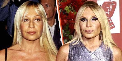 Before and After Donatella Versace Plastic Surgery - The Hub