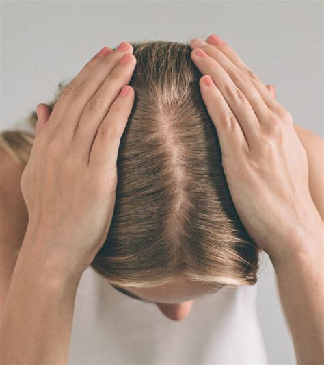 PCOS Hair Loss: Causes, Signs, Treatment, Remedies, And More