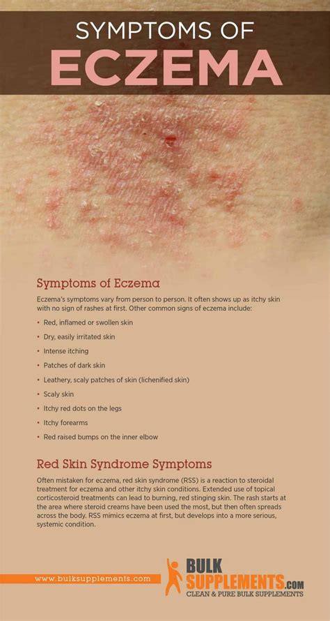 Eczema: Characteristics, Causes & Treatment | BulkSupplements.com