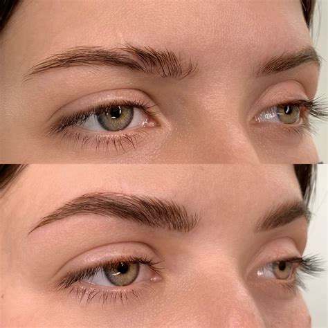 Scar Cover-ups Using Microblading - The Beauty Attic