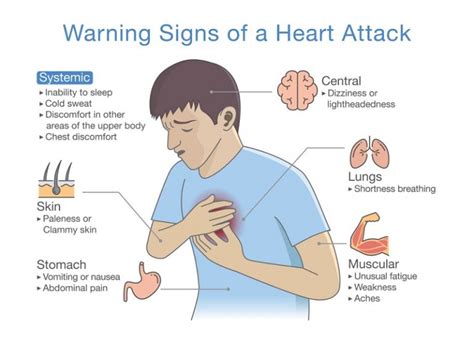 What are men's symptoms of a heart attack? Warning, Signs in Men