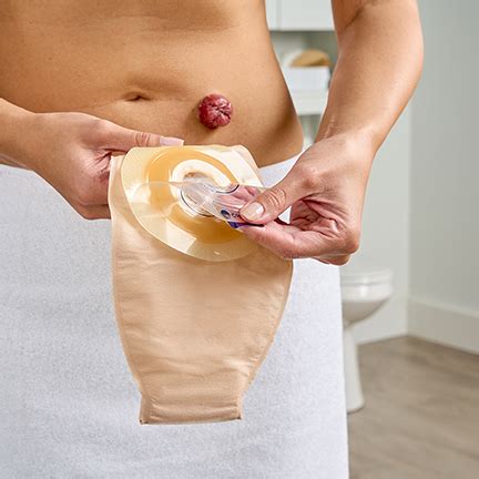 Stoma Paste Application: A How-To Guide