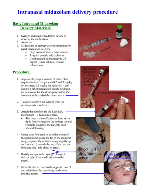 midazolam, intranasal delivery