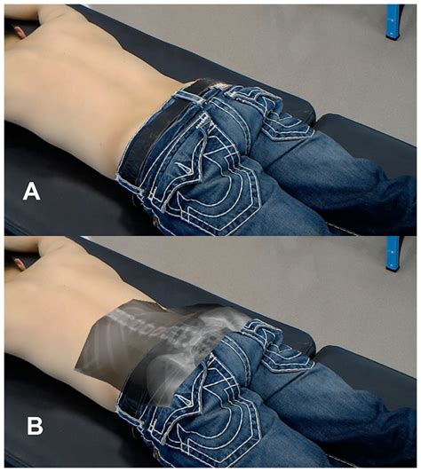 X-ray vision: the accuracy and repeatability of a technology that allows clinicians to see ...