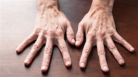 Hand Exercises for Rheumatoid Arthritis (RA) Relief | Everyday Health