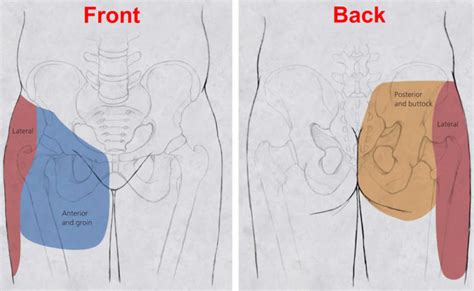 Hip pain causes, hip pain symptoms, diagnosis and hip pain treatment