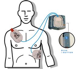 How to use an Automated External Defibrillator (AED) — Save-A-Life ...