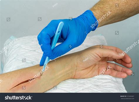 Incision wound 5,094 รายการ ภาพ ภาพสต็อกและเวกเตอร์ | Shutterstock