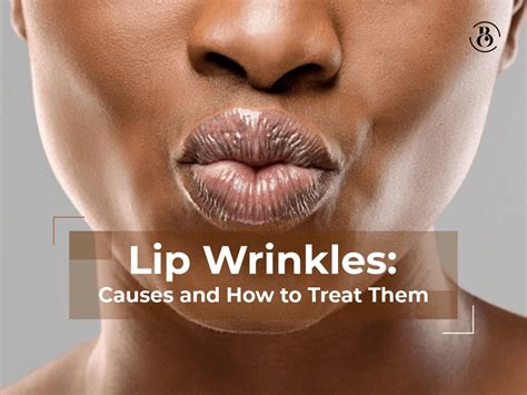 Lip Wrinkles: Causes and How to Treat Them - BeauCrest