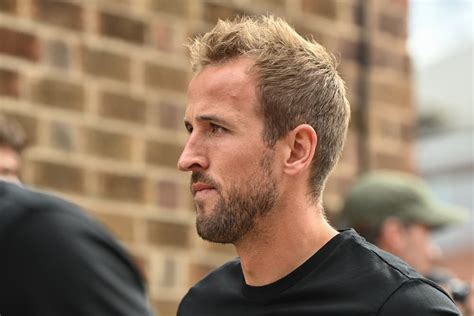 Harry Kane Hair Transplant Journey: Before & After Analysis