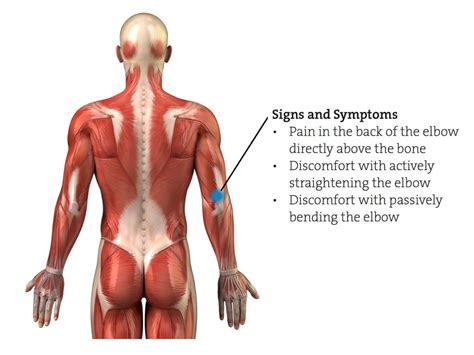 Triceps Tendonitis | Pain MD Houston | The Woodlands