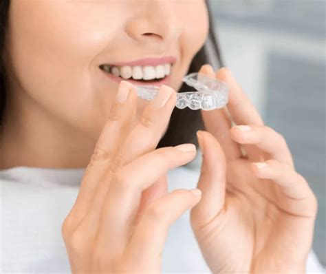 Best Invisible Aligners Treatment in Jaipur - Dr. Renu Dental Clini