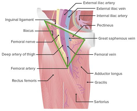 Femoral Canal Hernia