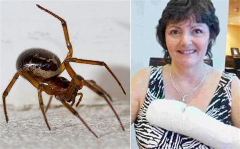 Woman nearly lost arm after black widow spider bite