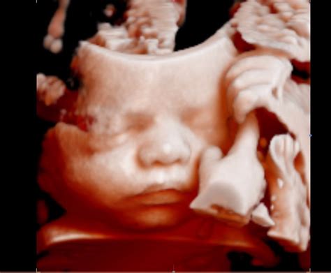 Premium Early Gender & 5D/4D/3D Baby Ultrasound - Price Beat Guarantee