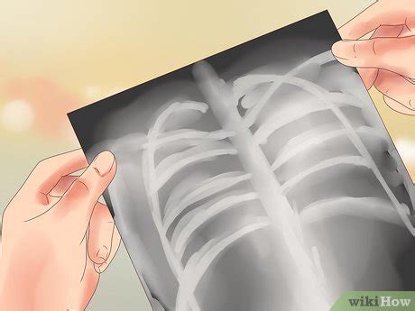 How to Diagnose Pulmonary Dyspnea Causes: 12 Steps (with Pictures)