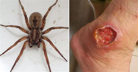 Brown Recluse Spiders Brown Recluse Spider Bite Brown Recluse Spider | Images and Photos finder