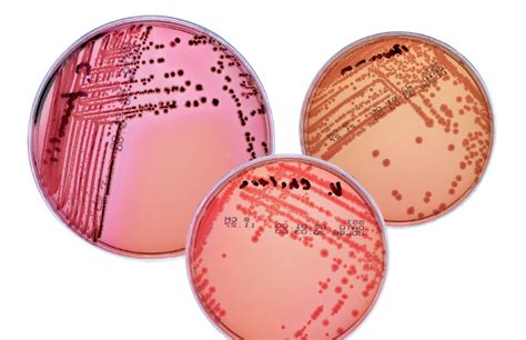 Clinical Microbiology - SSI Diagnostica