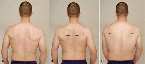 The Importance of Scapular protraction - Wealth Fits