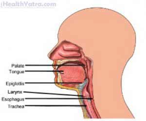 Epiglottitis Definition, Causes, Symptoms, Complications and Cost Surgery Treatment Hospital in ...