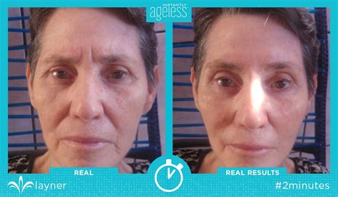 Instantly Ageless™ Before and After Photo Gallery, Jeunesse Global