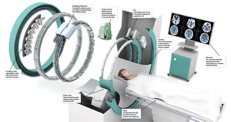 How does a CT scanner work? – How It Works