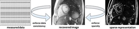 Depiction of a typical compressed sensing method employed for MRI ...