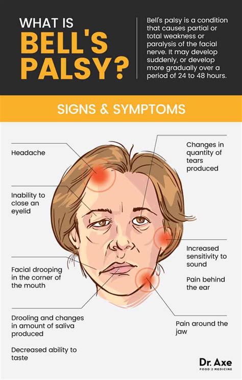 Bell's Palsy (+ 13 Natural Treatments for Bell's Palsy Symptoms) - Dr. Axe