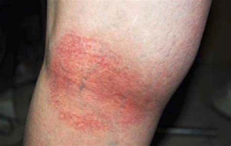 EM Coach: Solving a Rash of Problems | Emergency Physicians Monthly