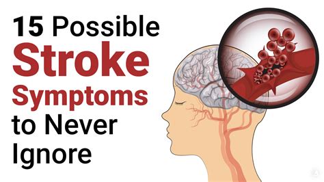 15 Stroke Symptoms That Doctors Ask You Not To Ignore