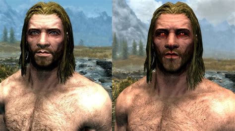 Skyrim: How to Cure Vampirism