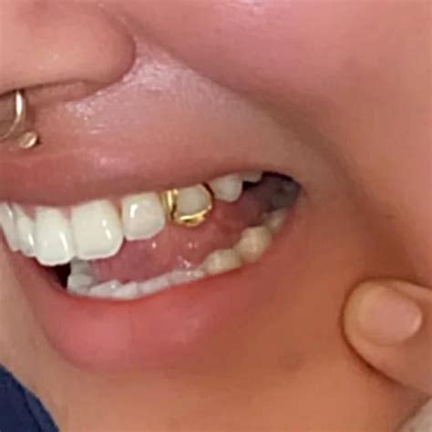 Real 14K Gold Open Face Canine Custom Tooth Cap Custom Grillz | Teeth caps, Gold teeth, Custom ...